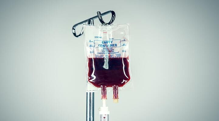 transfuzija krvi
