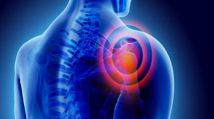 samo- masaža boli u ramenima artroza 2 stupnja i njegove obrade