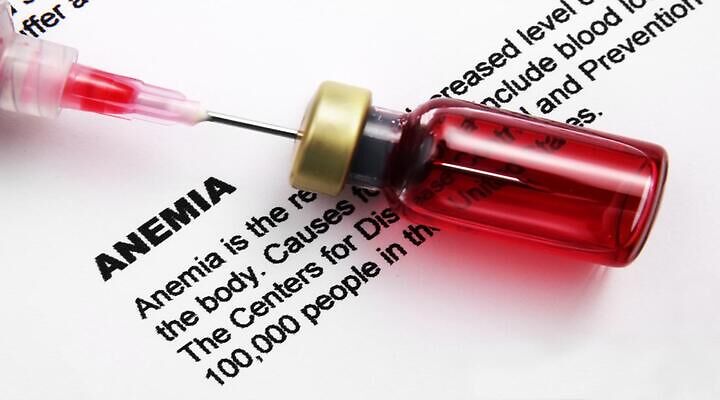 anemija nedostatka zglobova