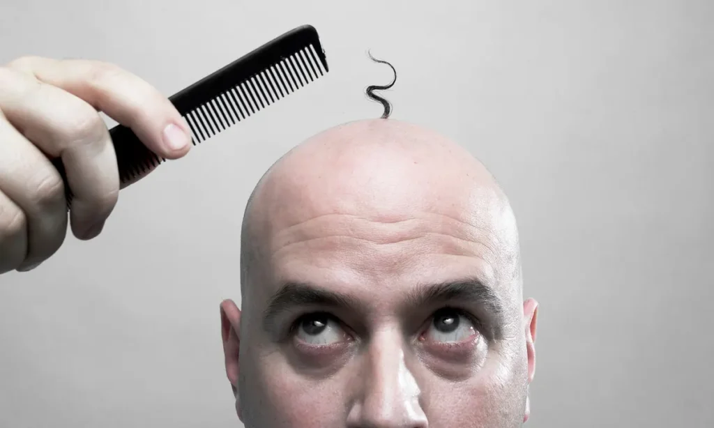 Kako sprečiti opadanje kose