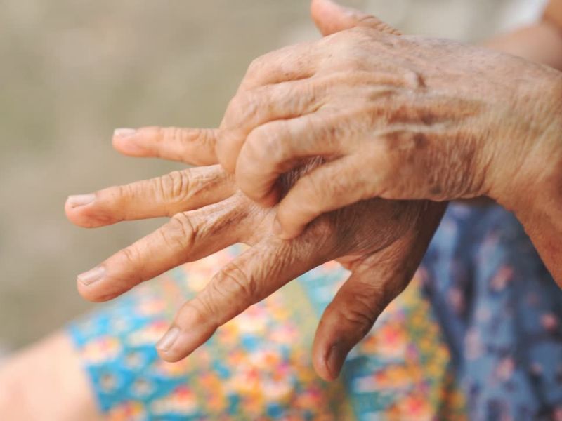starija osoba češe svoje dlanove