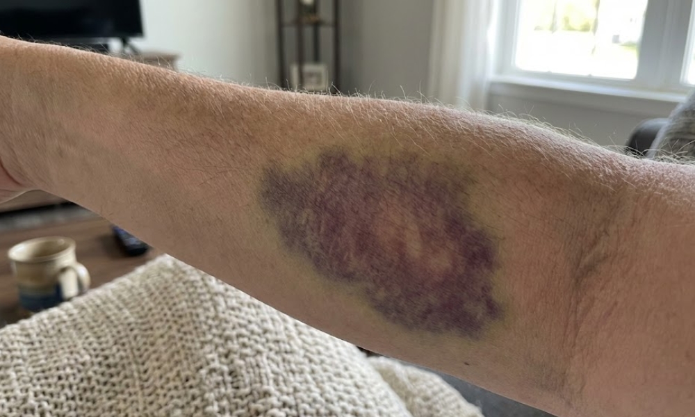 Kada je neophodno javiti se lekaru