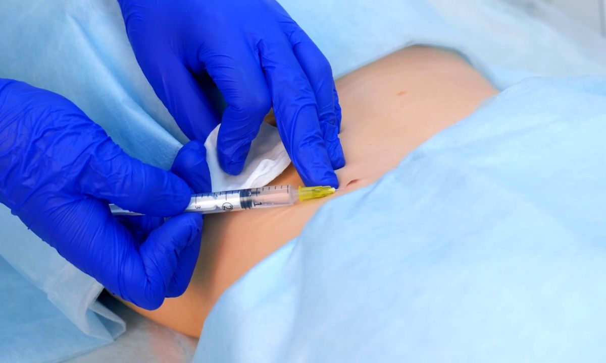 prikaz dermatologa koji daje anesteziju pacijentkinji