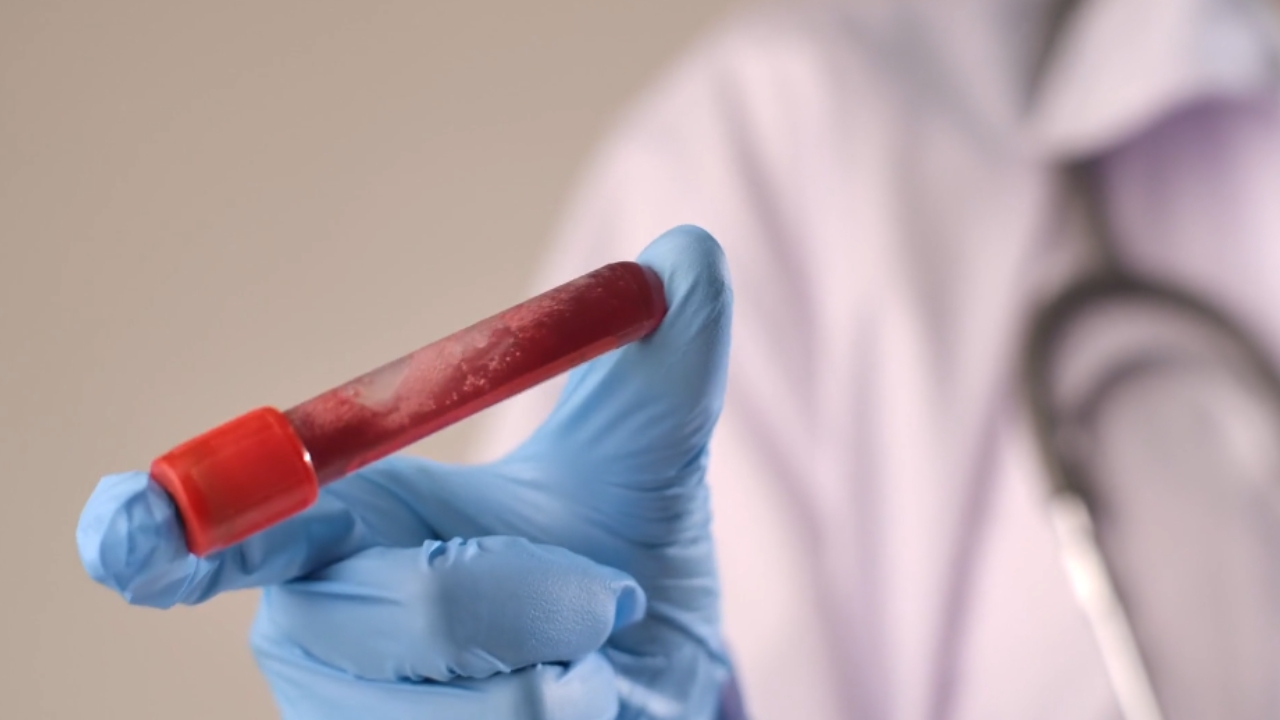 Lekar drži epruvetu sa uzorkom krvi za laboratorijsku analizu neutrofila