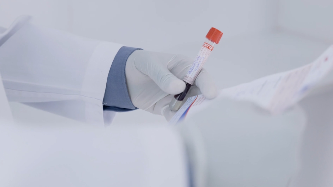 Laboratorijski radnik drži epruvetu sa uzorkom krvi za PCT analizu
